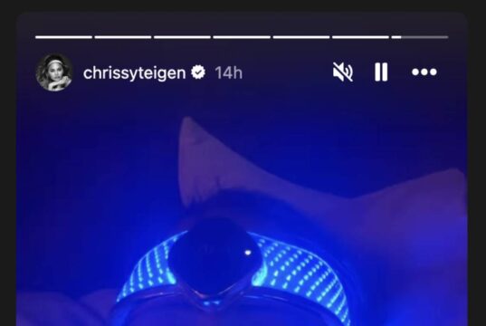 Chrissy Teigen új szépségtrükkje: LED fényterápia a ragyogó bőrért